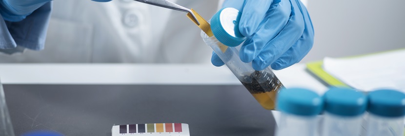 化學(xué)品哺乳動(dòng)物細(xì)胞基因突變試驗(yàn)